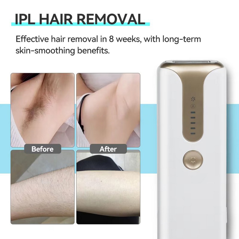 IPL laser hair removal machines